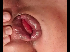 Gay man enjoying anal penetration to the point of rectal prolapse